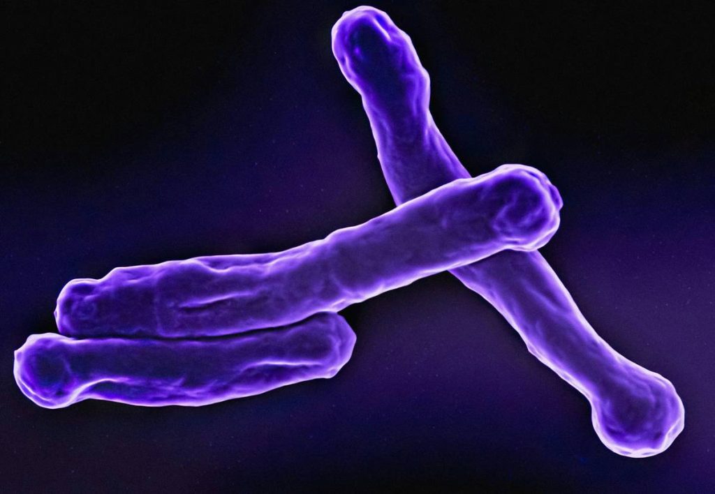 Are Probiotics Good for Gut Health: 7 Proven Ways to Avoid Costly Mistakes